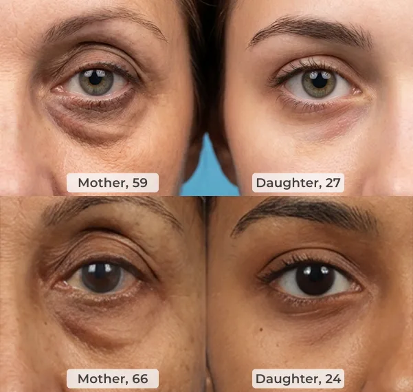 Dr. Melasmin Calcium Balm skin appearance comparison